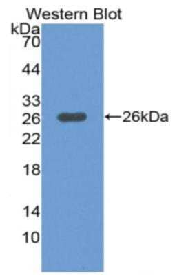 Western Blot: MEKK1 Antibody [NBP2-89023]