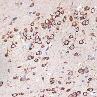 Immunohistochemistry-Paraffin: MEKK2 Antibody (9L5O3) [NBP3-15886]