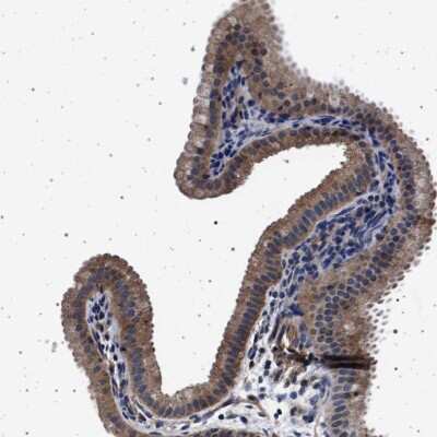Immunohistochemistry-Paraffin: MEKK2 Antibody [NBP2-48554]