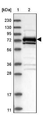 Western Blot: MEKK2 Antibody [NBP2-48554]