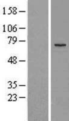 Western Blot: MEKK2 Overexpression Lysate [NBL1-12854]