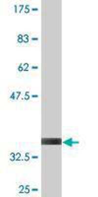 Western Blot: MEKK3 Antibody (1H3) [H00004215-M10]