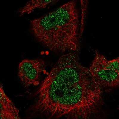 Immunocytochemistry/ Immunofluorescence: MEKK3 Antibody [NBP2-58303]