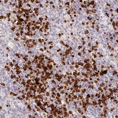 Immunohistochemistry-Paraffin: MEKK3 Antibody [NBP2-34004]