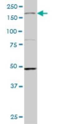 Western Blot: MEKK4 Antibody (4C3) [H00004216-M05]