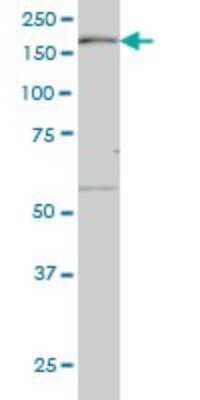 Western Blot: MEKK4 Antibody (4F10) [H00004216-M08]