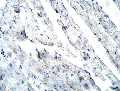 Immunohistochemistry-Paraffin: MEKK4 Antibody [NBP3-12324]