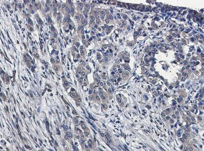 Immunohistochemistry-Paraffin: MEKK4 Antibody (S05-8A5) [NBP3-19990]