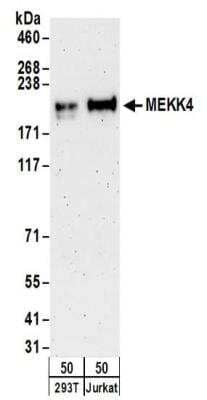 Western Blot: MEKK4 Antibody [NBP2-32187]