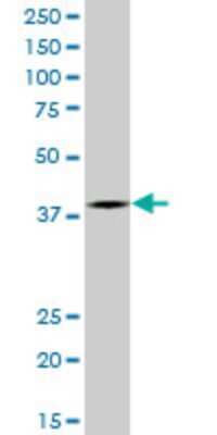 Western Blot: MEL-18 Antibody (2D6) [H00007703-M05]