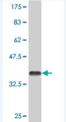 Western Blot: MEL-18 Antibody (3E4) [H00007703-M06]