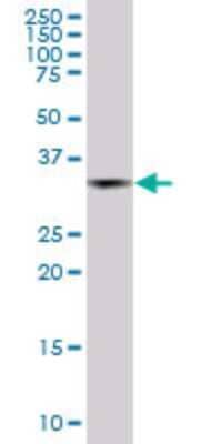 Western Blot: MEL-18 Antibody (4C10) [H00007703-M04]