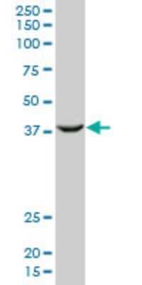 Western Blot: MEL-18 Antibody (4D6) [H00007703-M03]