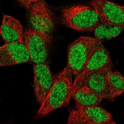 Immunocytochemistry/ Immunofluorescence: MEL-18 Antibody [NBP2-56458]