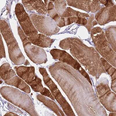 Immunohistochemistry-Paraffin: MEL-18 Antibody [NBP2-13739]