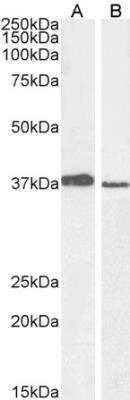 Western Blot: MEL-18 Antibody [NB100-1240]