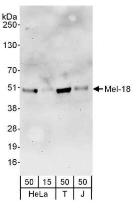 Western Blot: MEL-18 Antibody [NBP2-04032]