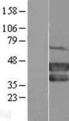 Western Blot: MEL-18 Overexpression Lysate [NBL1-14174]