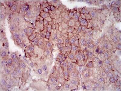 Immunohistochemistry: MELK Antibody (2G2) - BSA Free [NBP2-37481]