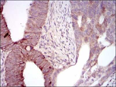 Immunohistochemistry: MELK Antibody (2G2) - BSA Free [NBP2-37481]