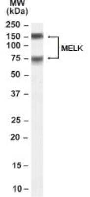 Western Blot: MELK Antibody [NB100-782]