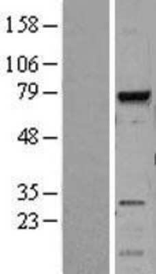 Western Blot: MELK Overexpression Lysate [NBL1-13007]