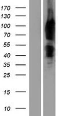 Western Blot: Mena Overexpression Lysate [NBP2-10991]