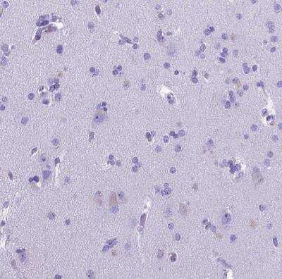 Immunohistochemistry-Paraffin: MEOX 2 Antibody [NBP2-30647]