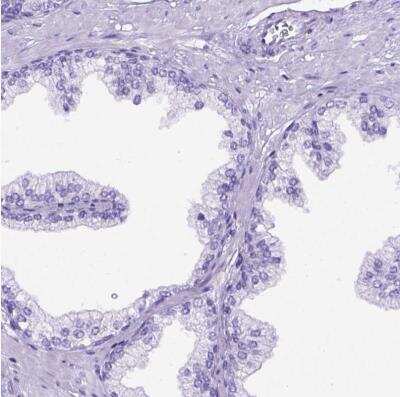 Immunohistochemistry-Paraffin: MEOX 2 Antibody [NBP2-30647]