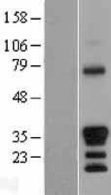 Western Blot: MEOX 2 Overexpression Lysate [NBL1-13011]