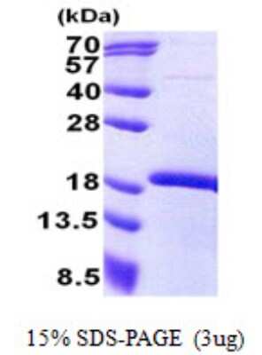 SDS-PAGE: Recombinant Human MEOX 2 His Protein [NBP2-23228]