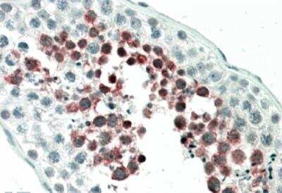 Immunohistochemistry-Paraffin: MEPCE Antibody [NB100-93420]