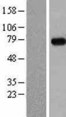 Western Blot: MEPCE Overexpression Lysate [NBL1-13012]