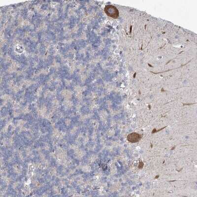 Immunohistochemistry: MEPE/OF45 Antibody [NBP2-32652]