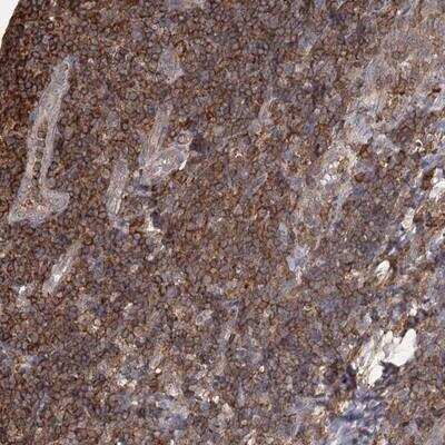 Immunohistochemistry: MEPE/OF45 Antibody [NBP1-90993]