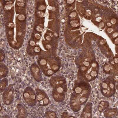 Immunohistochemistry: MERIT40/HSPC142 Antibody [NBP2-49568]