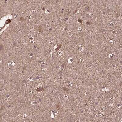 Immunohistochemistry-Paraffin: MERIT40/HSPC142 Antibody [NBP2-49568]