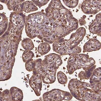 Immunohistochemistry-Paraffin: MERIT40/HSPC142 Antibody [NBP2-49568]