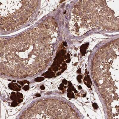 Immunohistochemistry-Paraffin: MERIT40/HSPC142 Antibody [NBP2-49568]