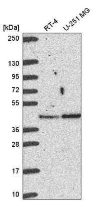 Western Blot: MERIT40/HSPC142 Antibody [NBP2-58126]