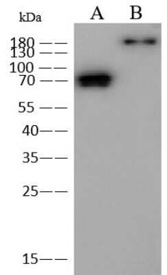 Western Blot: MERS-CoV Spike Protein Antibody [NBP3-18800]