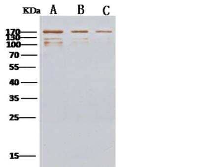 Western Blot: MERS-CoV Spike Protein Antibody [NBP3-05814]