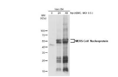 Western Blot: MERS-CoV Nucleoprotein Antibody [NBP3-13422]