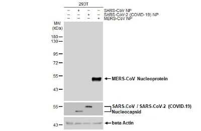 Western Blot: MERS-CoV Nucleoprotein Antibody [NBP3-13422]