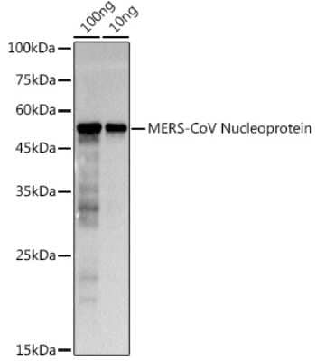 Western Blot: MERS-CoV Nucleoprotein AntibodyAzide and BSA Free [NBP3-16057]