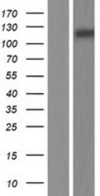 Western Blot: Mer Overexpression Lysate [NBP2-07636]