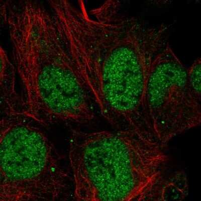 Immunocytochemistry/ Immunofluorescence: MESDC1 Antibody [NBP2-68923]