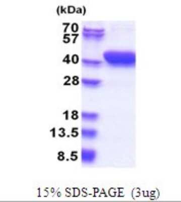 SDS-PAGE: Recombinant Human MESDC1 His Protein [NBP2-51670]