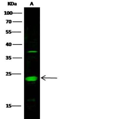 Western Blot: MESDC2 Antibody (502) [NBP2-89719]