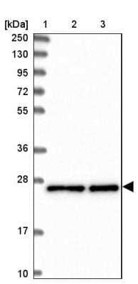 Western Blot: MESDC2 Antibody [NBP1-88555]